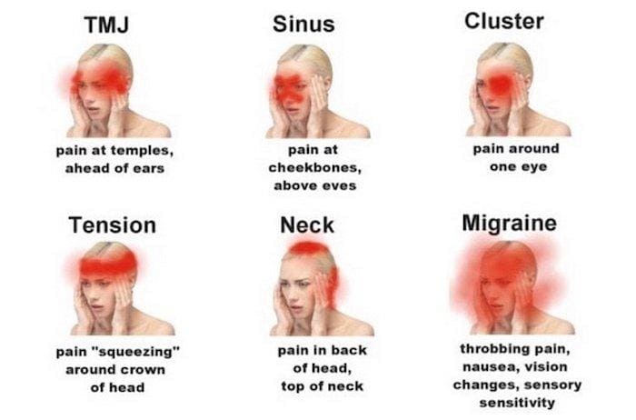 Sharp Pain On Right Side Of Head And Eye That Comes And Goes