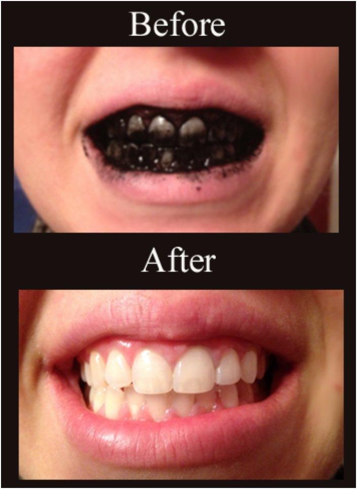 19+ where can i buy natural food coloring Teeth whitening charcoal activated effective recipes easy recipe