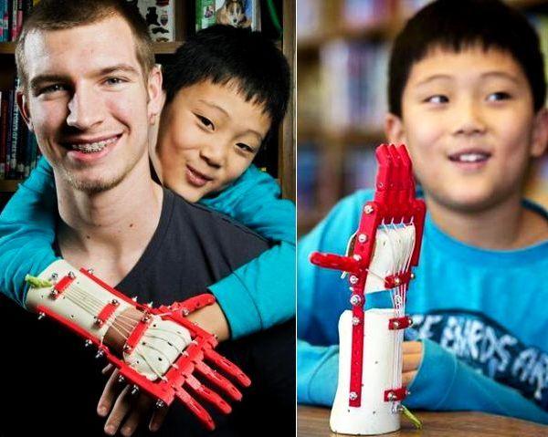 3D-printed-Prosthetic-hand-by-Jason-Wilde-for-Matthew