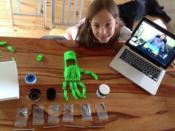 girl-11-year-old-Sierra-prosthetic-hands-2