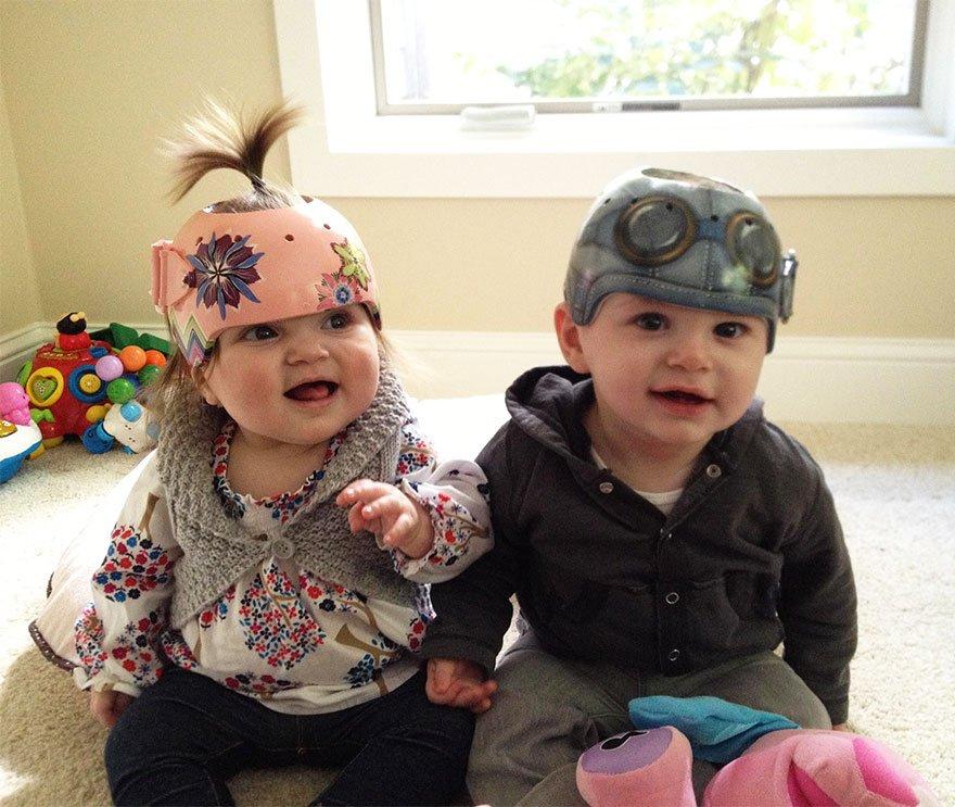 20 Cute And Fun Helmets For Babies With Plagiocephaly