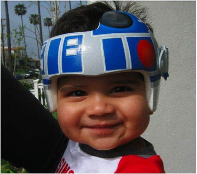 20 Cute And Fun Helmets For Babies With Plagiocephaly