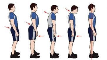 See How to Fix Your Posture With 3 Simple Positions - WELCOME