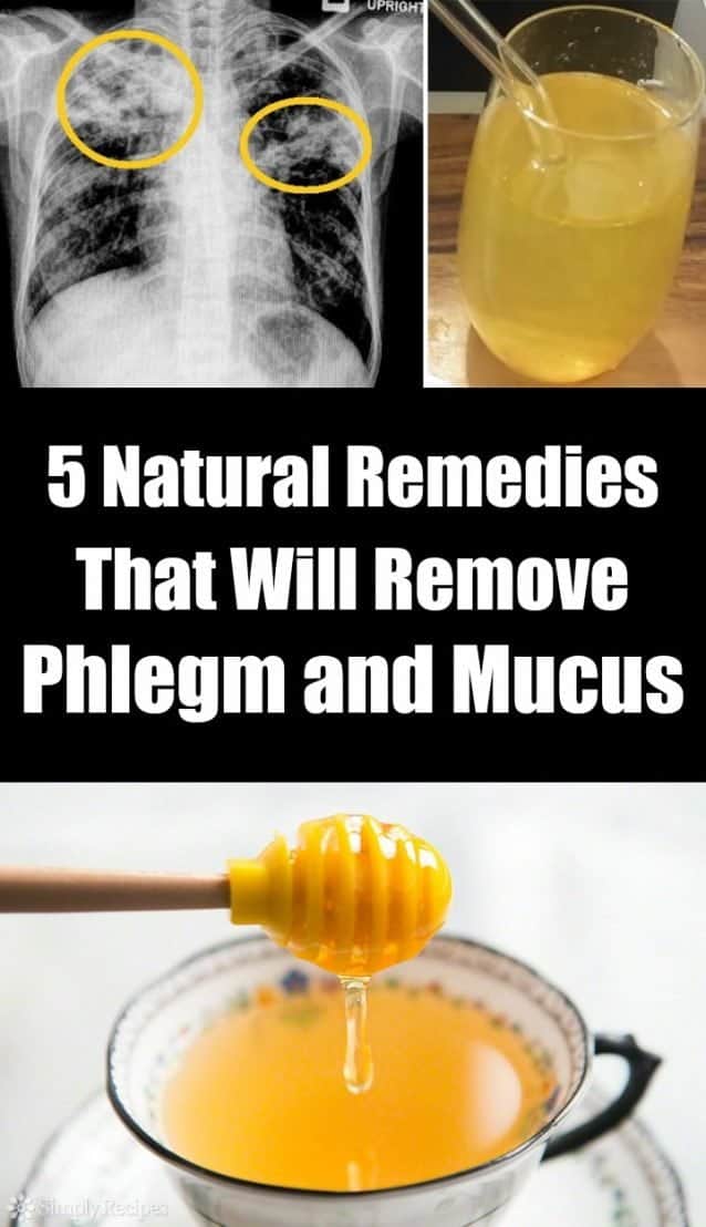 5 Natural Remedies That Will Remove Phlegm And Mucus