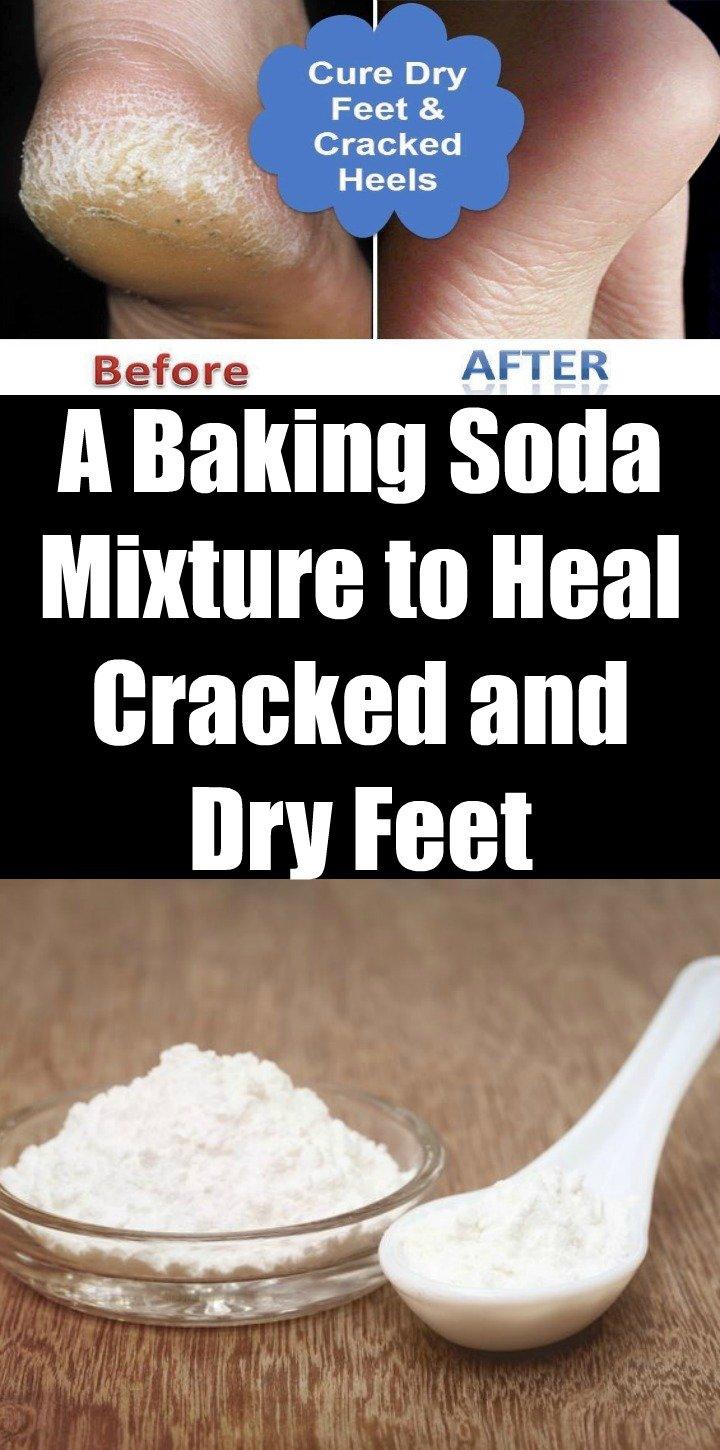 Baking soda mixture