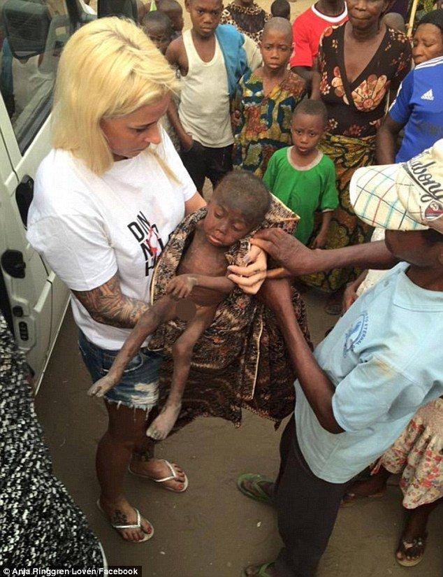 Remember The Nigerian 'Witch' Boy Who Was Left To Starve To Death? Wait Till You See Him Now!