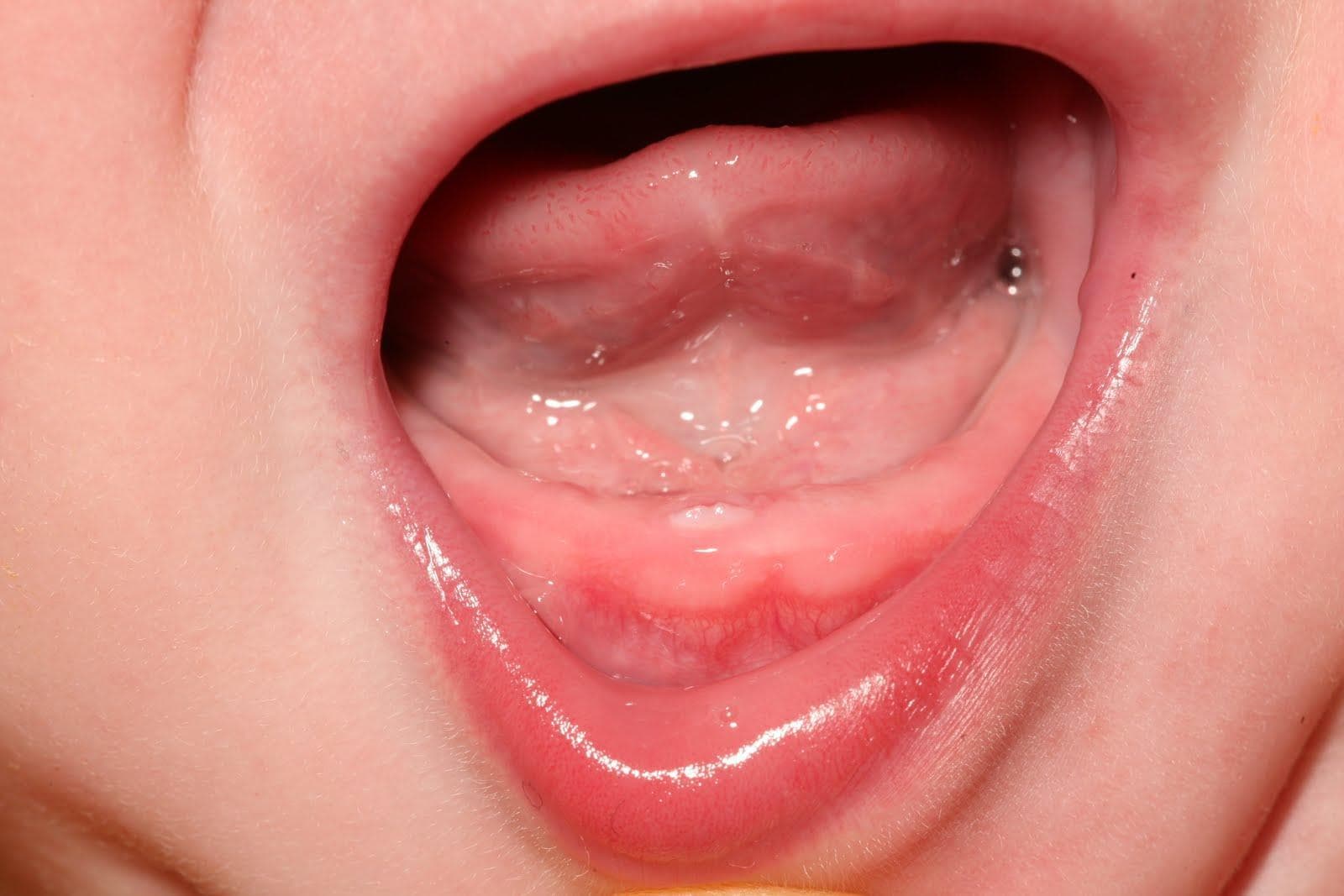 Teething Symptoms Pay Attention to these Small Signs Your Baby Shows