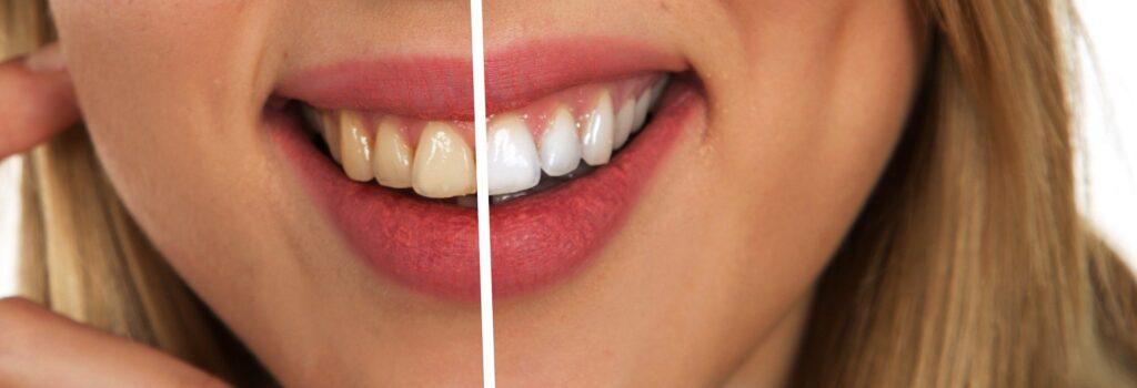 dental care