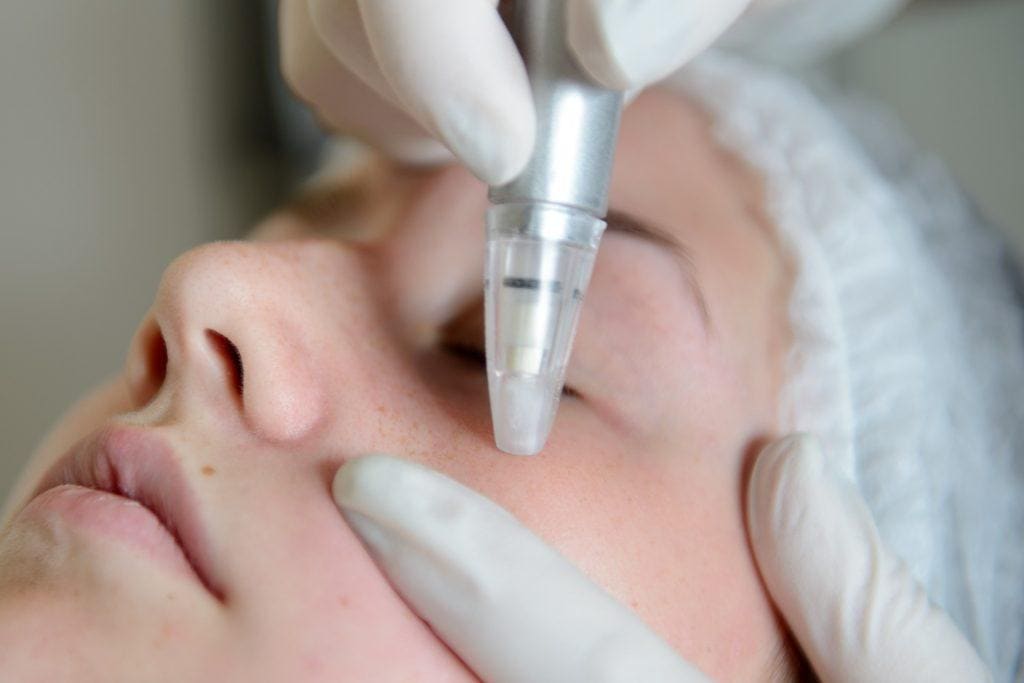 Skin with Microdermabrasion