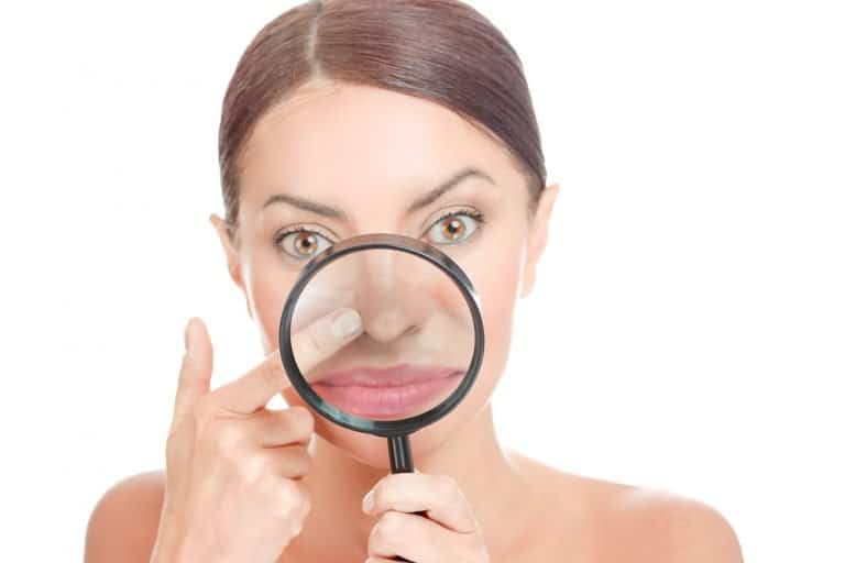Acne blackheads on woman's Oily Nose
