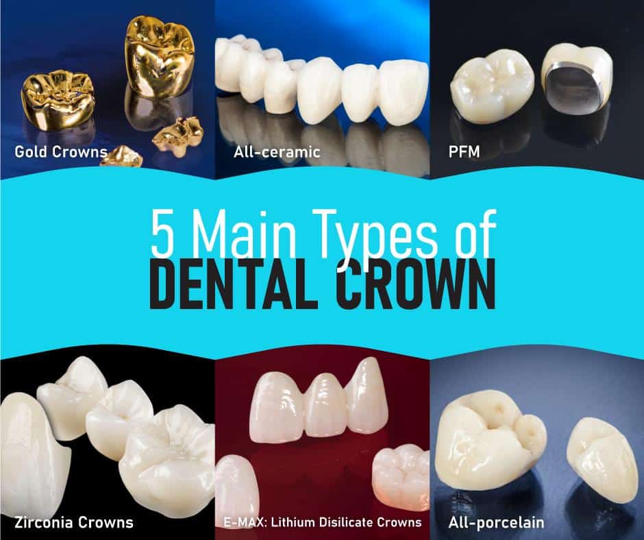 types-of-dental-crowns-procedure-and-cost