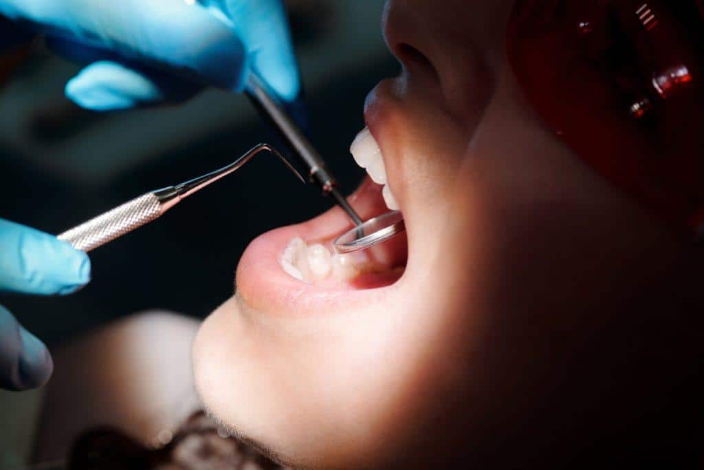 How to Cheat on a Mouth Swab Drug Test
