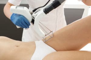 Laser Hair Removal for the Bikini Area Who Should Consider It And How Much Does It Cost