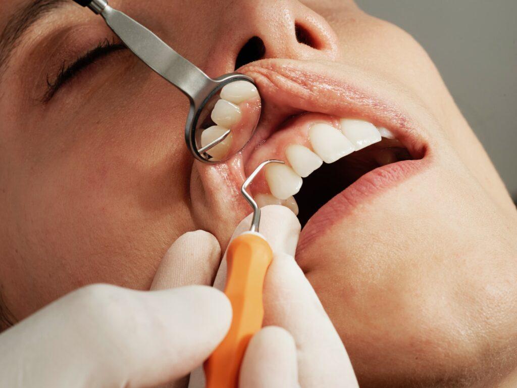 7 Best Practices For Maintaining Healthy Gums